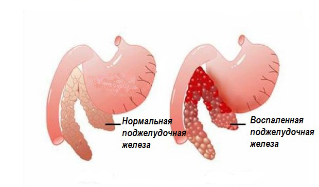 Панкреатит у собак