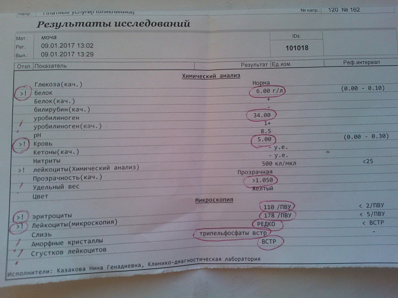 Анализ почечного камня