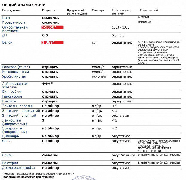 Лейкоцитарная эстераза в моче. Анализ мочи микроскопия. Общий анализ мочи мкб. Белок отрицательный в моче что это. Общий анализ мочи методом сухой химии.
