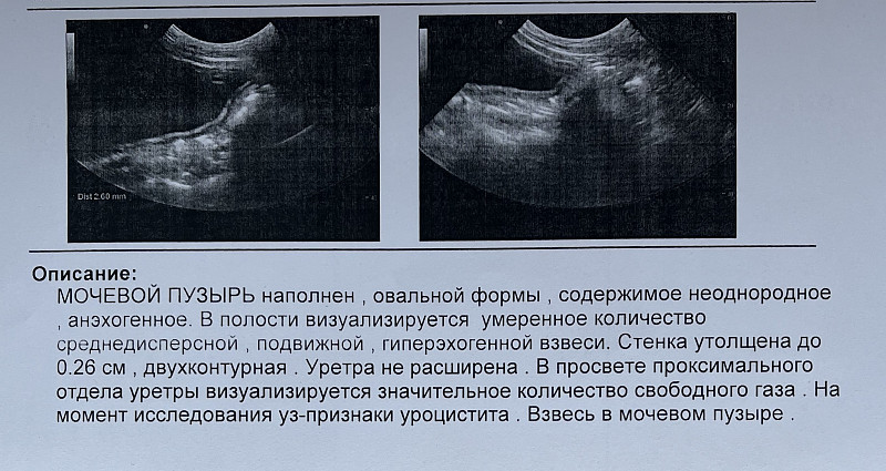 УЗИ мочевого пузыря в Санкт-Петербурге | Медицинский центр «Генезис»