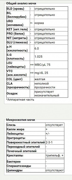 Что значит в моче у женщин. Моча общий анализ норма у женщин. Нормальные показатели общего анализа мочи у женщин. Нормы анализа мочи у взрослых женщин. Анализ крови ОАМ расшифровка.