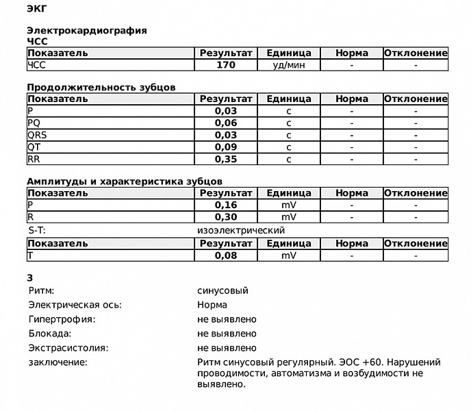 Недостаточность митрального клапана | Südamekeskus